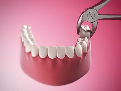 Elevate Dental | ClearCorrect&reg;, Preventative Program and Teeth Whitening