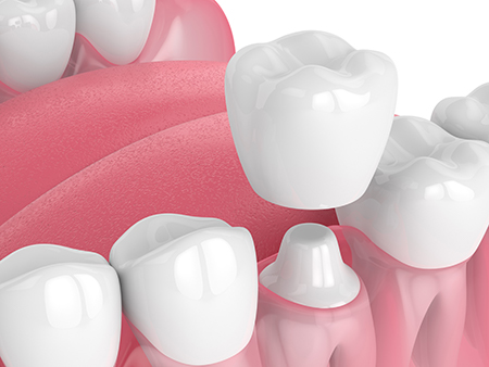 Elevate Dental