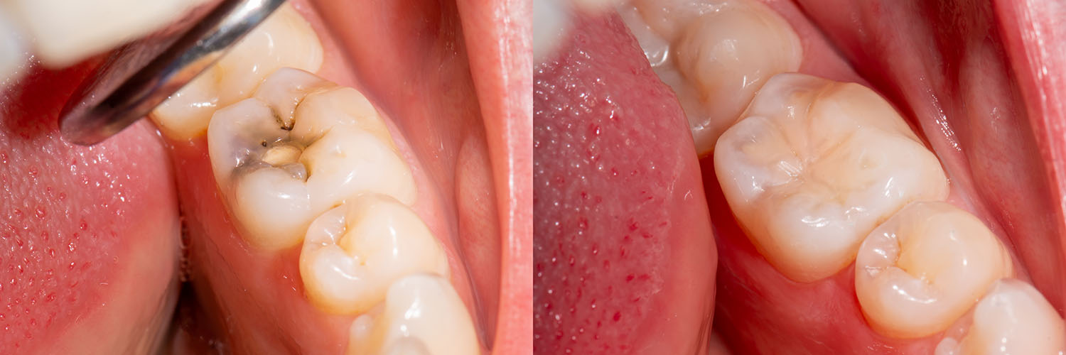 Elevate Dental