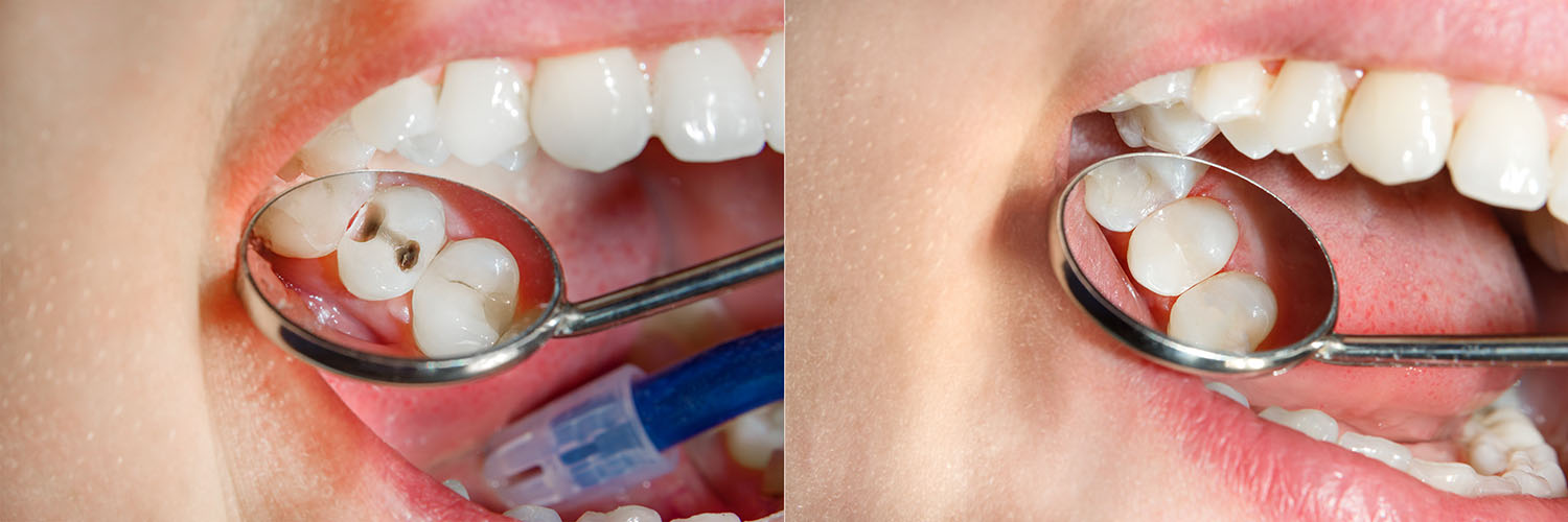 Elevate Dental